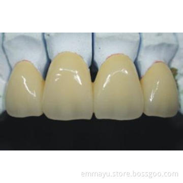 Gold palladium Alloy Ceramic teeth